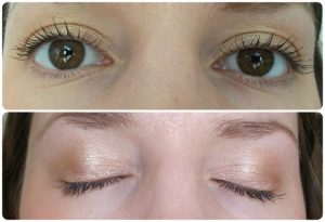 Summer eye