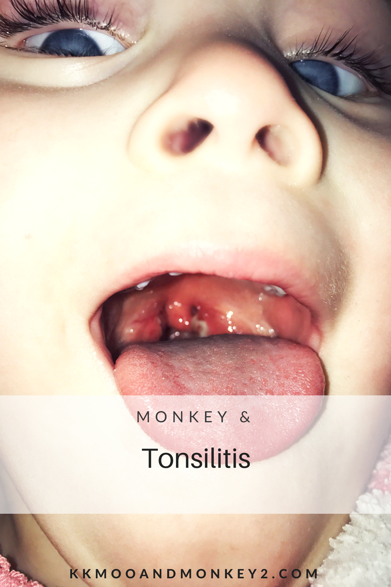 Tonsillitis archive image from our 2017 family post